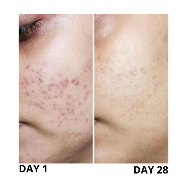 Deviant skincare europe - floraison exclusive customs-free shipping