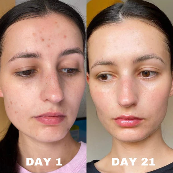 Deviant skincare europe - floraison exclusive customs-free shipping